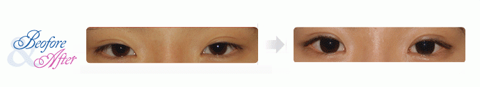 Oculoplastic_2.gif
