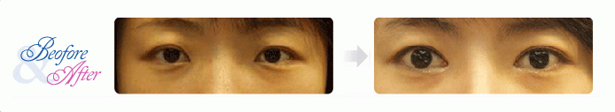 Oculoplastic.gif