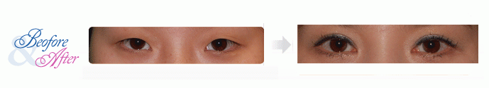 Oculoplastic_8.gif
